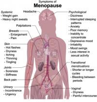 Symptoms of menopause