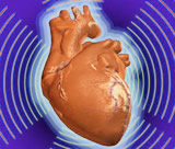 Tachycardia