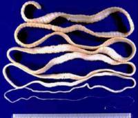 Taenia solium