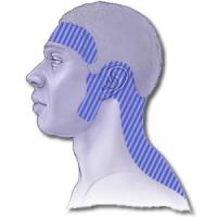 Tension-type headache