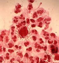 Trichomonas
