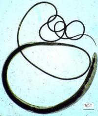 Trichuris trichiura female
