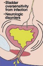 Urge incontinence