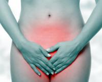 Vaginal candidiasis